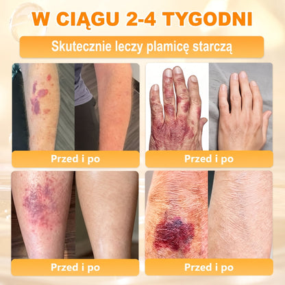 Wyprodukowano i wysłano z Polski 🐝🍀 PUROSA® Krem odnowy skóry z jadem pszczelim 🔥 Ostatni dzień – 50% zniżki 🔥