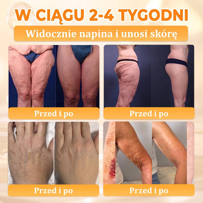 Wyprodukowano i wysłano z Polski 🐝🍀 PUROSA® Krem odnowy skóry z jadem pszczelim 🔥 Ostatni dzień – 50% zniżki 🔥