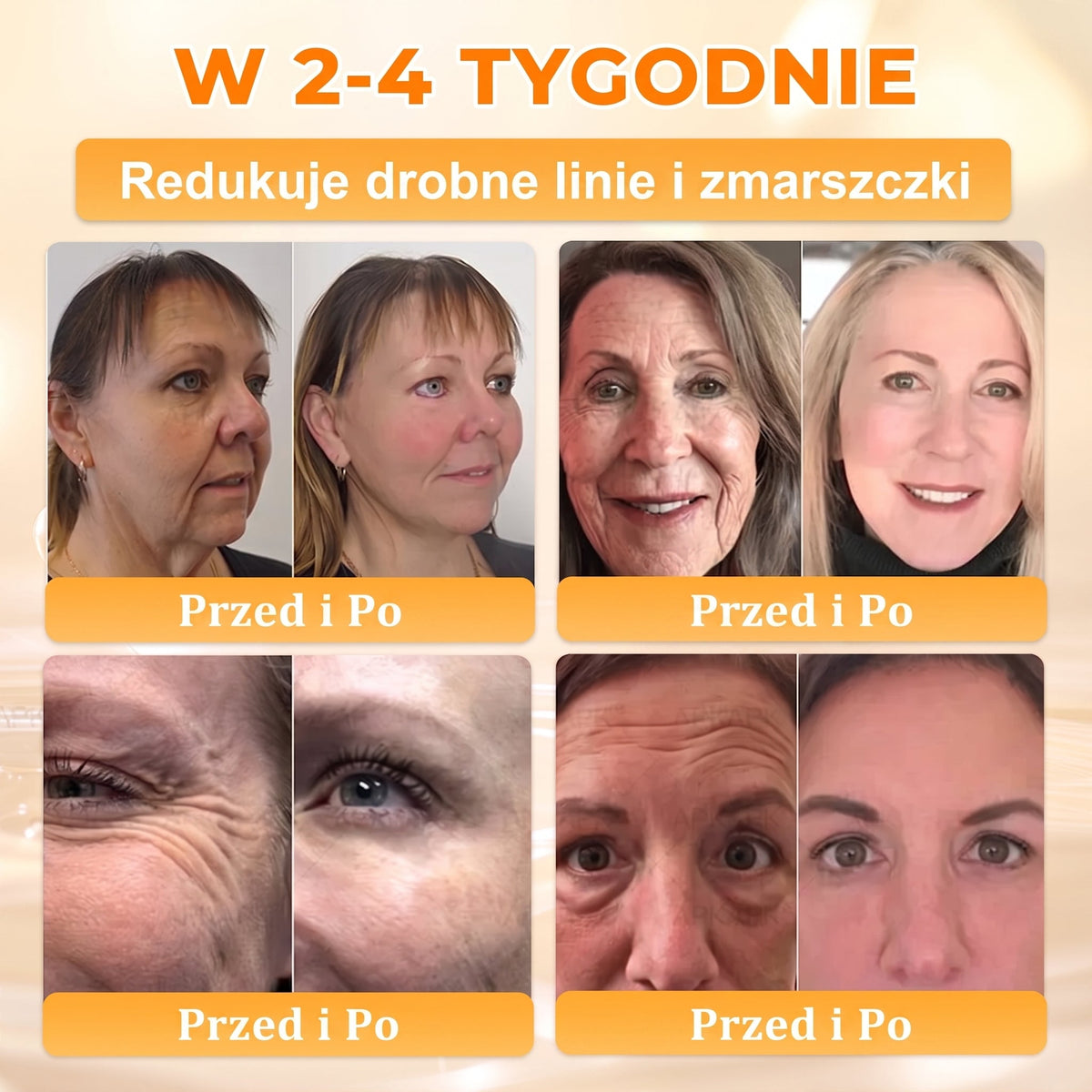 Wyprodukowano i wysłano z Polski 🐝🍀 PUROSA® Krem odnowy skóry z jadem pszczelim 🔥 Ostatni dzień – 50% zniżki 🔥