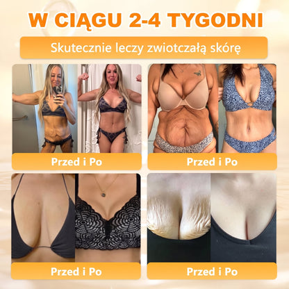 Wyprodukowano i wysłano z Polski 🐝🍀 PUROSA® Krem odnowy skóry z jadem pszczelim 🔥 Ostatni dzień – 50% zniżki 🔥