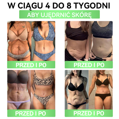 ⏰ Zostało już tylko 5 pudełek! Oferujemy Państwu dodatkowe 50% rabatu! Bądź fit i zdrowy. Jeśli przegrasz teraz, kolejną szansę dostaniesz dopiero w przyszłym roku.
