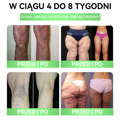 ⏰ Zostało już tylko 5 pudełek! Oferujemy Państwu dodatkowe 50% rabatu! Bądź fit i zdrowy. Jeśli przegrasz teraz, kolejną szansę dostaniesz dopiero w przyszłym roku.