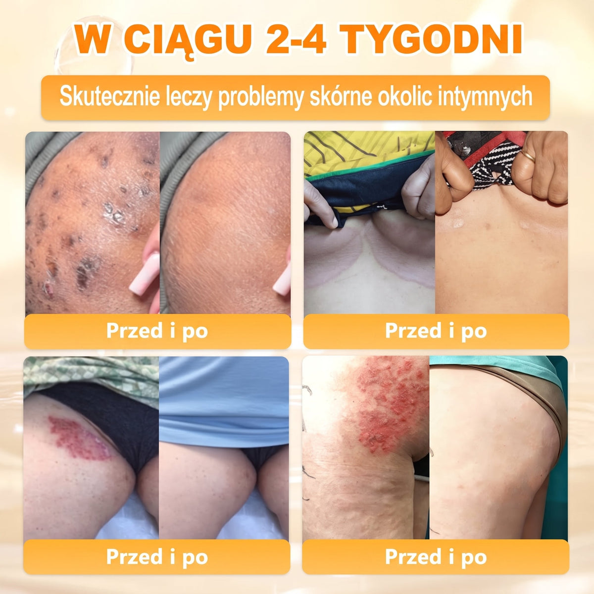 Wyprodukowano i wysłano z Polski 🐝🍀 PUROSA® Krem odnowy skóry z jadem pszczelim 🔥 Ostatni dzień – 50% zniżki 🔥