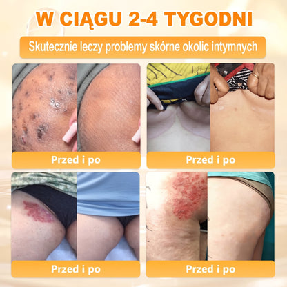 Wyprodukowano i wysłano z Polski 🐝🍀 PUROSA® Krem odnowy skóry z jadem pszczelim 🔥 Ostatni dzień – 50% zniżki 🔥