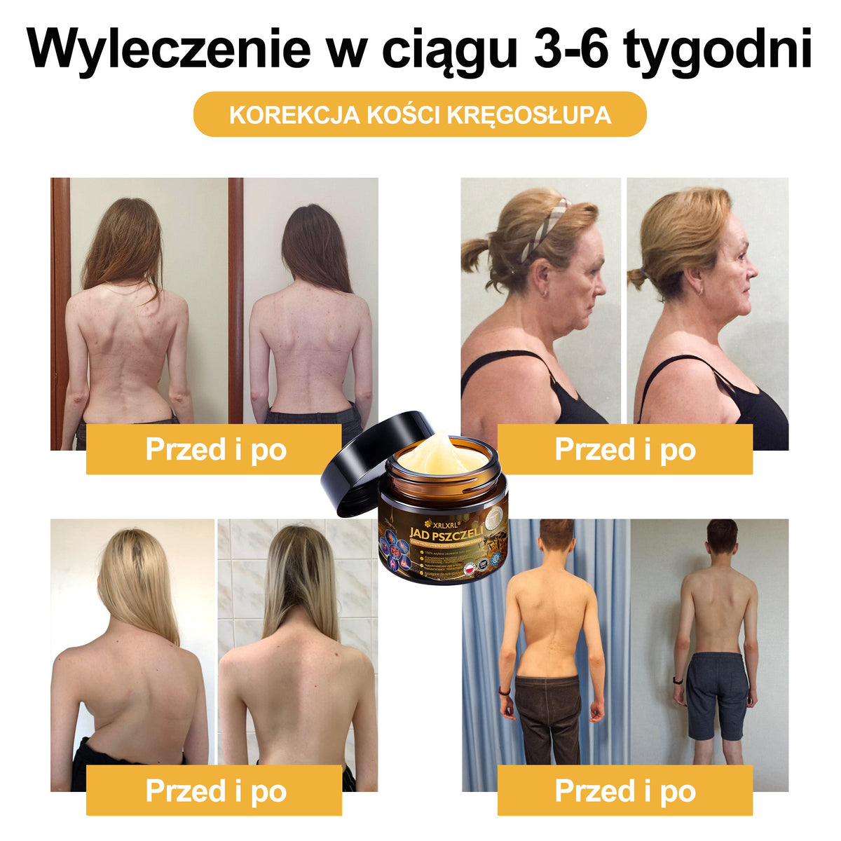 Oficjalny sklep: 🧑‍⚕️Krem przeciwbólowy XRLXRL® Bee Venom Instant Ultra Strength - (Łagodzi ból spowodowany zapaleniem stawów, bólem mięśni, bólem pleców, kolan, pleców, ramion, bioder, nadgarstków, dłoni)