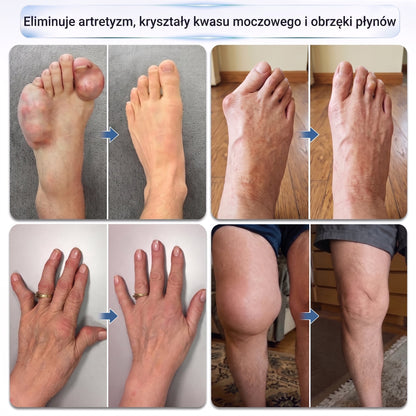 XRLXRL®🦴 ORTOPEDYCZNA TECHNOLOGIA REGENERACJI NOWEJ GENERACJI Roll-on do regeneracji kości i stawów z mikroigłami 0,05 mm