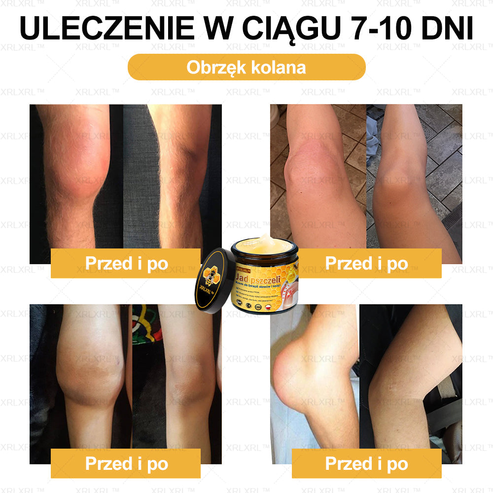 𝐗𝐑𝐋𝐗𝐑𝐋™  𝑲𝒓𝒆𝒎 Ł𝗮𝗴𝗼𝗱𝘇ą𝗰𝘆 𝘽ó𝙡 𝙞 𝙇𝙚𝙘𝙯𝙚𝙣𝙞𝙚 𝐊𝐨ś𝐜𝐢 𝐳  𝑱𝒂𝒅ł𝒆𝒎 𝙋𝙨𝙯𝙘𝙯𝙚𝙡𝙞𝒎 (Specjalnie zaprojektowane dla osób starszych i polecane przez Polskie Towarzystwo Ortopedyczne)