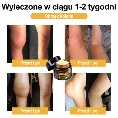 Oficjalny sklep: 🧑‍⚕️Krem przeciwbólowy XRLXRL® Bee Venom Instant Ultra Strength - (Łagodzi ból spowodowany zapaleniem stawów, bólem mięśni, bólem pleców, kolan, pleców, ramion, bioder, nadgarstków, dłoni)