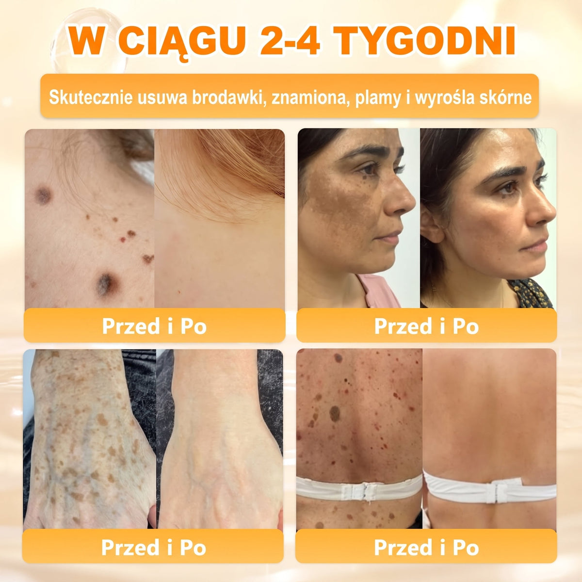 Wyprodukowano i wysłano z Polski 🐝🍀 PUROSA® Krem odnowy skóry z jadem pszczelim 🔥 Ostatni dzień – 50% zniżki 🔥