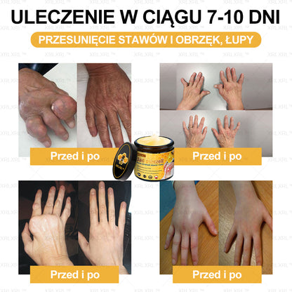 𝐗𝐑𝐋𝐗𝐑𝐋™  𝑲𝒓𝒆𝒎 Ł𝗮𝗴𝗼𝗱𝘇ą𝗰𝘆 𝘽ó𝙡 𝙞 𝙇𝙚𝙘𝙯𝙚𝙣𝙞𝙚 𝐊𝐨ś𝐜𝐢 𝐳  𝑱𝒂𝒅ł𝒆𝒎 𝙋𝙨𝙯𝙘𝙯𝙚𝙡𝙞𝒎 (Specjalnie zaprojektowane dla osób starszych i polecane przez Polskie Towarzystwo Ortopedyczne)