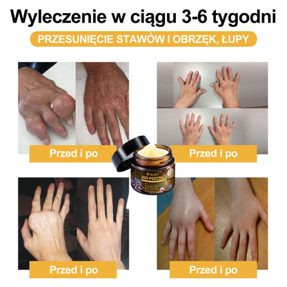 Oficjalny sklep: 🧑‍⚕️Krem przeciwbólowy XRLXRL® Bee Venom Instant Ultra Strength - (Łagodzi ból spowodowany zapaleniem stawów, bólem mięśni, bólem pleców, kolan, pleców, ramion, bioder, nadgarstków, dłoni)