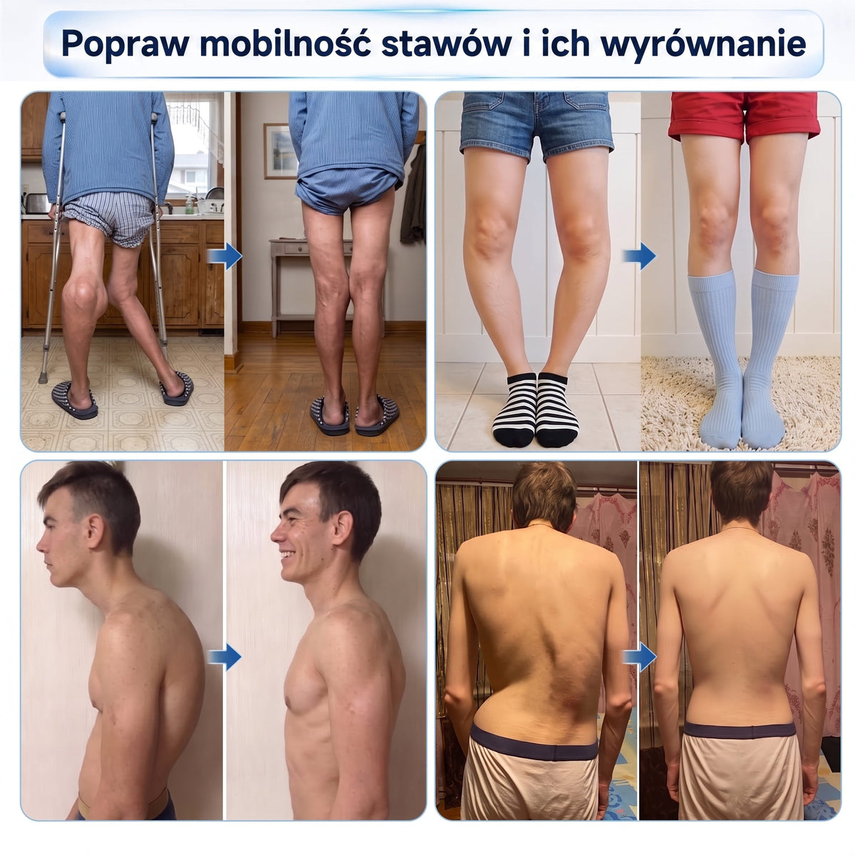 XRLXRL®🦴 ORTOPEDYCZNA TECHNOLOGIA REGENERACJI NOWEJ GENERACJI Roll-on do regeneracji kości i stawów z mikroigłami 0,05 mm