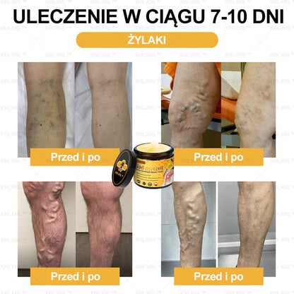 𝐗𝐑𝐋𝐗𝐑𝐋™  𝑲𝒓𝒆𝒎 Ł𝗮𝗴𝗼𝗱𝘇ą𝗰𝘆 𝘽ó𝙡 𝙞 𝙇𝙚𝙘𝙯𝙚𝙣𝙞𝙚 𝐊𝐨ś𝐜𝐢 𝐳  𝑱𝒂𝒅ł𝒆𝒎 𝙋𝙨𝙯𝙘𝙯𝙚𝙡𝙞𝒎 (Specjalnie zaprojektowane dla osób starszych i polecane przez Polskie Towarzystwo Ortopedyczne)