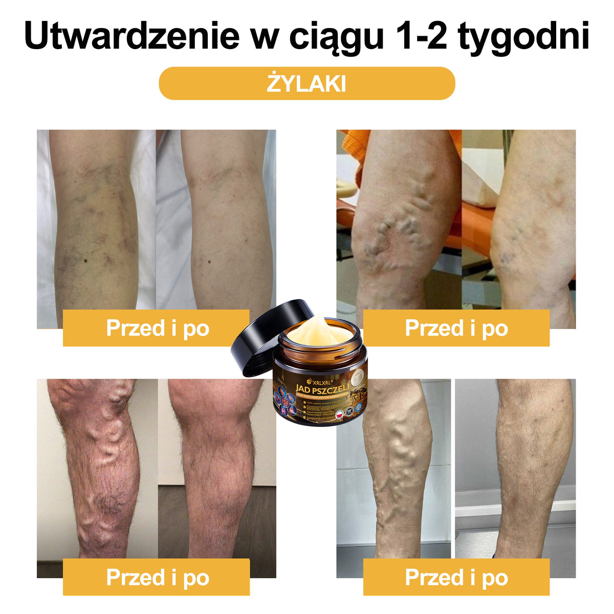 Oficjalny sklep: 🧑‍⚕️Krem przeciwbólowy XRLXRL® Bee Venom Instant Ultra Strength - (Łagodzi ból spowodowany zapaleniem stawów, bólem mięśni, bólem pleców, kolan, pleców, ramion, bioder, nadgarstków, dłoni)