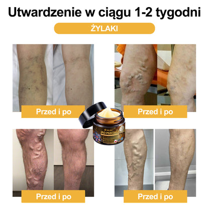 Oficjalny sklep: 🧑‍⚕️Krem przeciwbólowy XRLXRL® Bee Venom Instant Ultra Strength - (Łagodzi ból spowodowany zapaleniem stawów, bólem mięśni, bólem pleców, kolan, pleców, ramion, bioder, nadgarstków, dłoni)