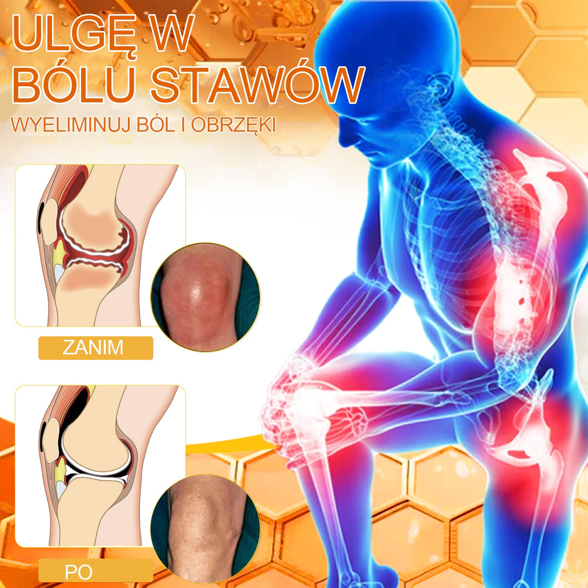 Oficjalny sklep: 🧑‍⚕️Krem przeciwbólowy XRLXRL® Bee Venom Instant Ultra Strength - (Łagodzi ból spowodowany zapaleniem stawów, bólem mięśni, bólem pleców, kolan, pleców, ramion, bioder, nadgarstków, dłoni)