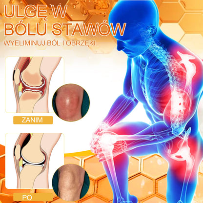 Oficjalny sklep: 🧑‍⚕️Krem przeciwbólowy XRLXRL® Bee Venom Instant Ultra Strength - (Łagodzi ból spowodowany zapaleniem stawów, bólem mięśni, bólem pleców, kolan, pleców, ramion, bioder, nadgarstków, dłoni)